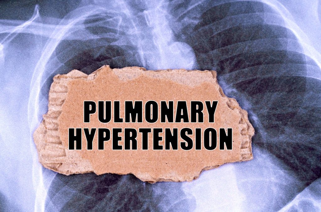 how-to-cope-with-pulmonary-hypertension-promo-numenta